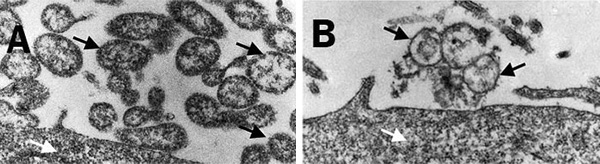Electron microscope image showing the effects of Mynox when applied to contaminated cell cultures