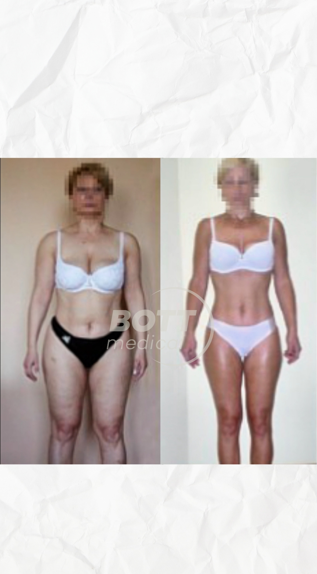 Efekty Przed Pośladki