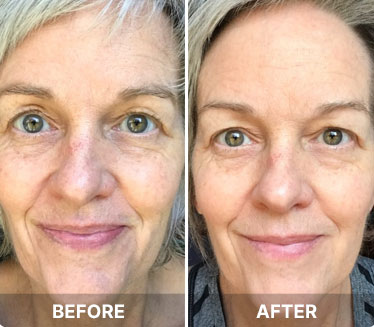 Common.Elements.Image.Web