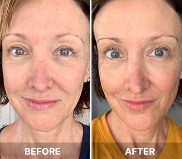 Common.Elements.Image.Web