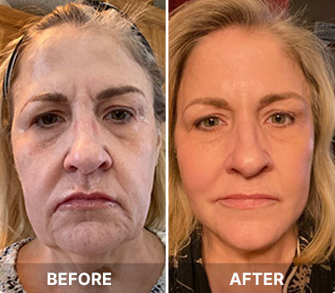 Common.Elements.Image.Web